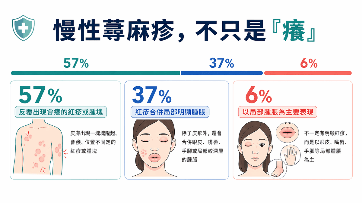慢性蕁麻疹反覆發作怎麼辦？上篇：臨床表現與發病機轉